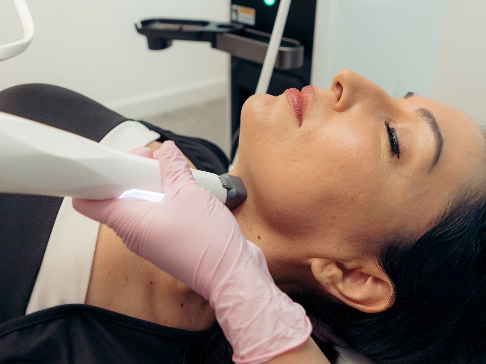 XERF skin tightening treatment at Helio Health and Wellness
